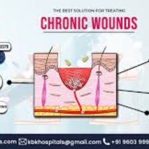 Causes of non-healing wounds