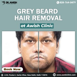 Grey beard treatment in delhi ncr