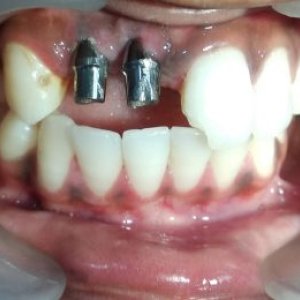 Dentist in faridabad sector 9