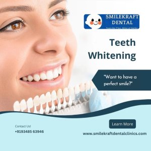 Achieve a brighter smile with professional teeth whitening