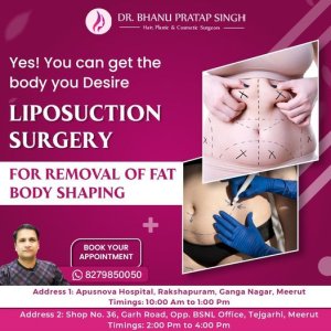 Liposuction surgery in ncr