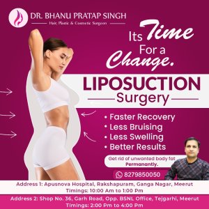 Best liposuction surgery in ncr