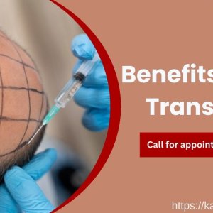 Benefits of hair transplant