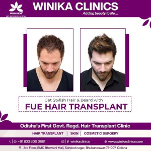 Best hair transplant clinic in bhubaneswar