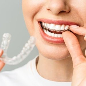 Orthodontists in abudhabi