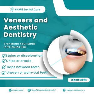 Best dental care in nagpur – khare dental clinic | dentist near