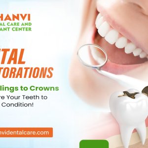 Dental restoration treatment vivekananda nagar