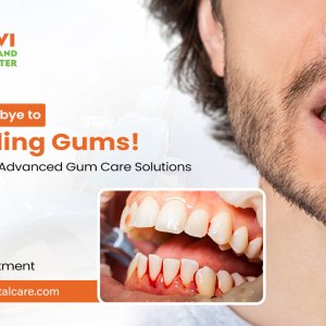 Gums treatment vivekanandanagar