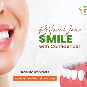 Best dental implants vivekananda nagar