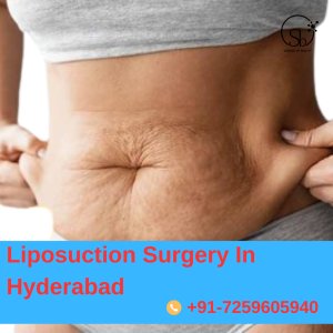 Best liposuction surgery in hyderabad | transform your body tod