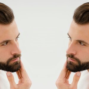 Beard hair transplant: to change your style