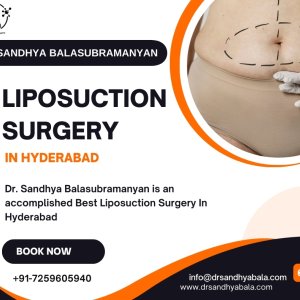 Transform your body with expert liposuction surgery in hyderabad