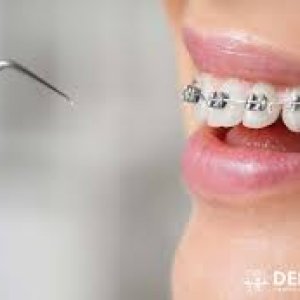 Orthodontic treatment abudhabi