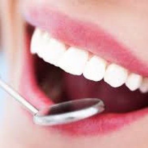 Teeth cleaning and whitening abudhabi