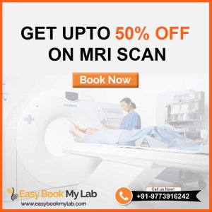 Best mri centre in delhi – affordable & advanced mri services