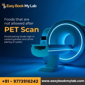 Best pet ct scan centre in delhi | easy book my lab