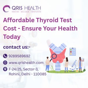 Affordable thyroid test cost - ensure your health today