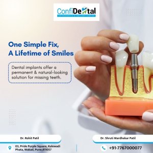 Confidental dental clinic and implant center in wakad |best orth